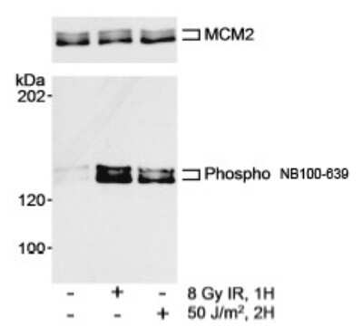 Western Blot: MCM2 [p Ser108] Antibody [NB100-639] - Detection of Human phospho MCM2 (Ser108) by Western Blot. Samples: Whole cell lysate from HeLa cells that were untreated or exposed to 8 Gy IR for 1 h or 50 J/m2 for 2 hours. Antibody: Affinity purified rabbit anti-phospho MCM2 (Ser108) antibody (Cat. No. NB100-639) used at 0.2 mcg/ml. Subsequently, total MCM2 was detected to verify loading. Detection: Chemiluminescence with an exposure time of 5 seconds.